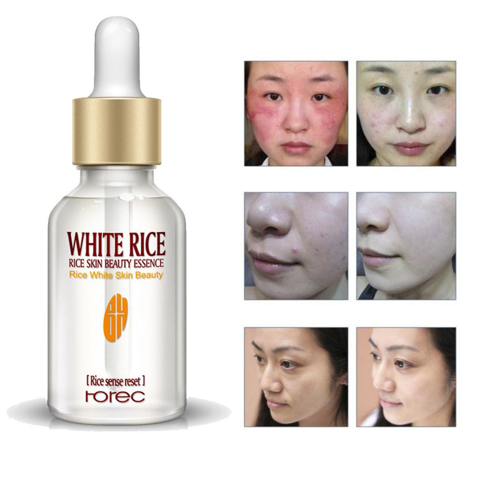 15ML Skin Nourishing And Moisturizing White Rice Serum Essence-UlGadget