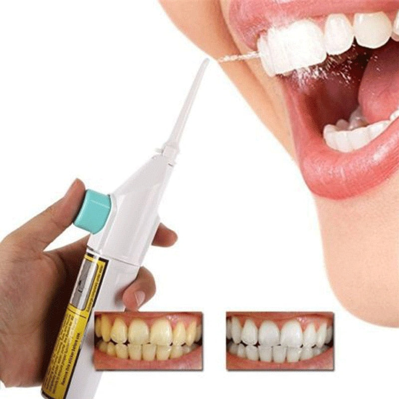 Oral Hygiene Care Air Technology Oral Irrigator Dental Power Floss-UlGadget