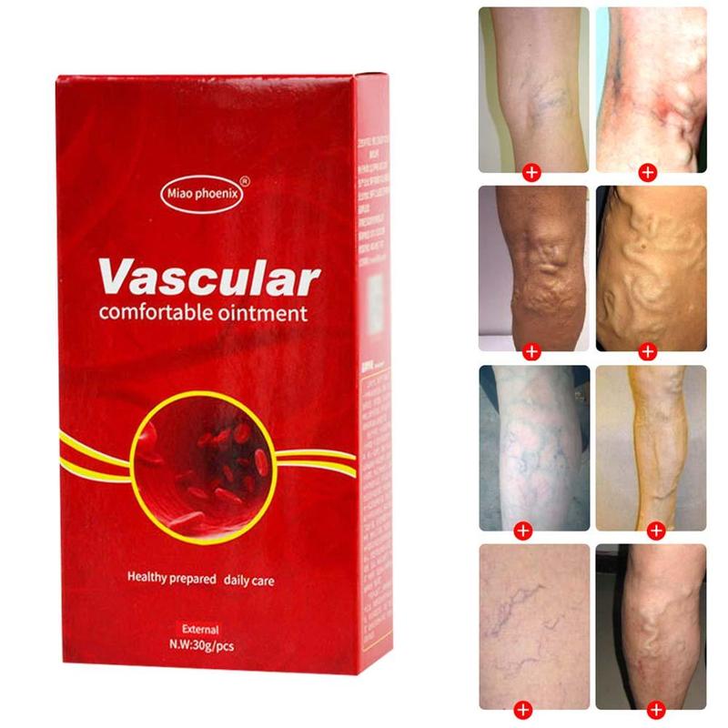 Varicose Veins Treatment Cream Ointment Vasculitis Phlebitis Spider Veins Removal Herbal Cream-UlGadget