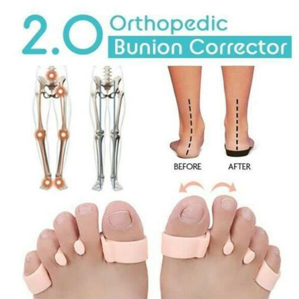 2/4PCS Adjuster Bone Foot Care Hallux Valgus Pedicure Orthopedic Bunion Corrector-UlGadget