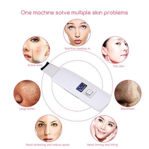 Ultrasonic Skin Scrubber Face Cleanser Blackhead Acne Removal-UlGadget