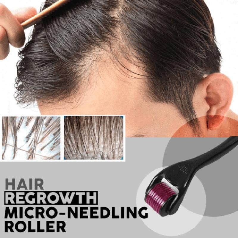 Hair Regrowth Micro-needling Roller-UlGadget