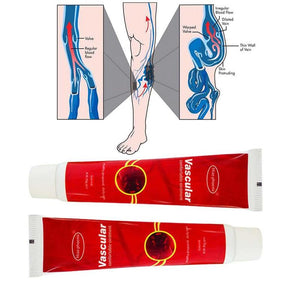 Varicose Veins Treatment Cream Ointment Vasculitis Phlebitis Spider Veins Removal Herbal Cream-UlGadget