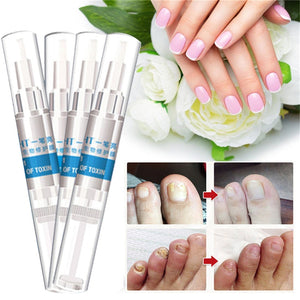 3ml Eucony Fast Acting Infection Nail Cure Treatment Pen (4PCS)-UlGadget